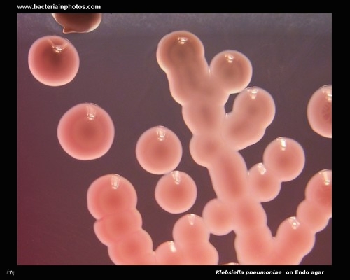 klebsiella on endo